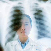 Pneumonia related image